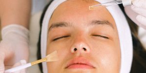 Lee más sobre el artículo Peeling químicos o limpieza tradicional ¿Qué es mejor para la limpieza facial?